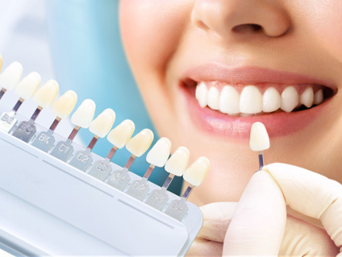 In Chair Teeth Whitening Toowoomba